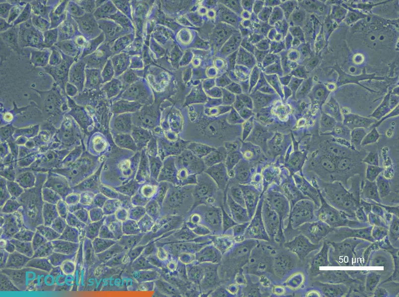 Human Bronchial Epithelial Cell Complete Medium - small - 5