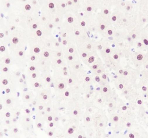 Recombinant ATF1 Monoclonal Antibody - small - 2