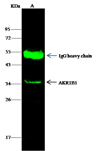 Recombinant AKR1B1 Monoclonal Antibody - small - 2