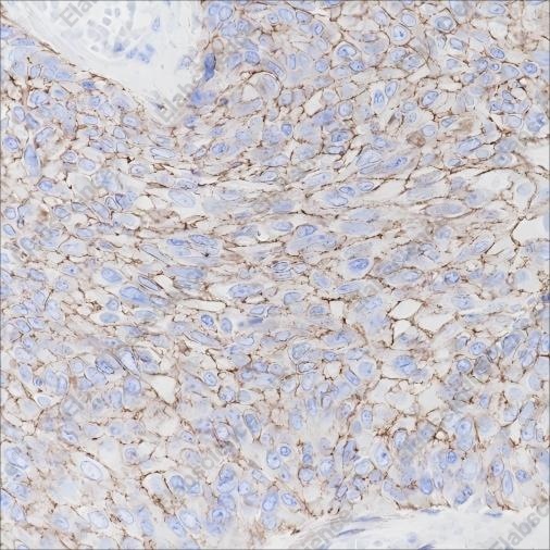 Recombinant CD138/Syndecan-1 Monoclonal Antibody - 2