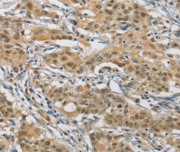 NAPSA Polyclonal Antibody - 3