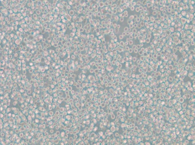 WIL2 S Cell Complete Medium - small - 5