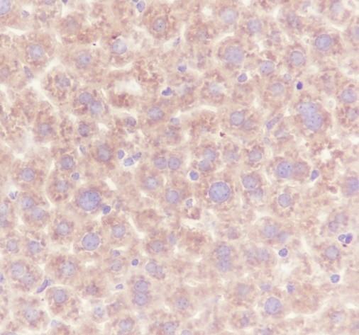 Recombinant TNF receptor II Monoclonal Antibody - small - 3