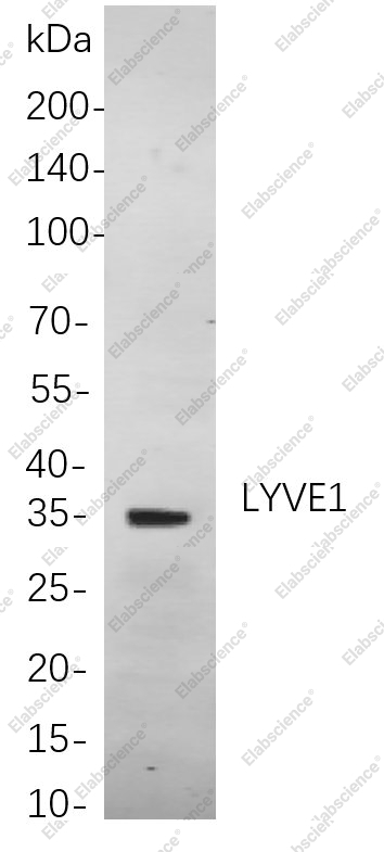 Recombinant LYVE1 Monoclonal Antibody - 1