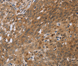 NDUFS2 Polyclonal Antibody - 3