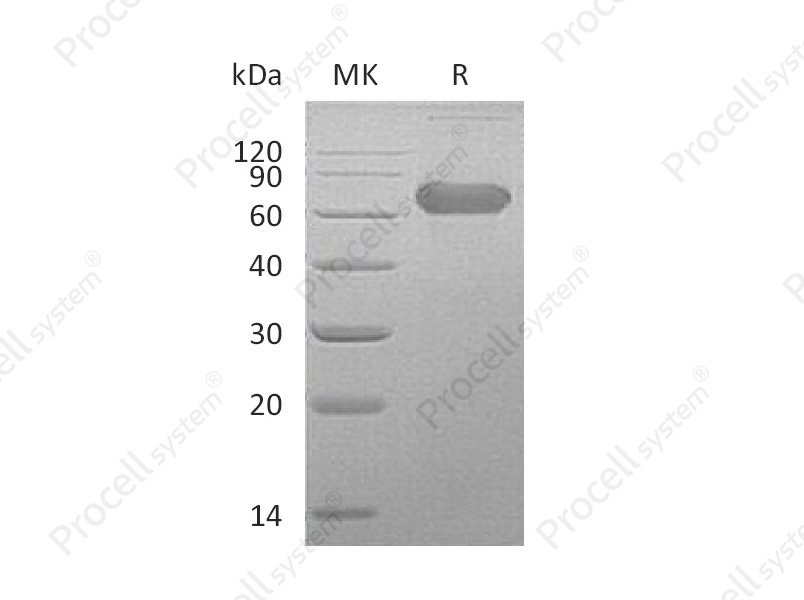 LTBR/TNFRSF3/TNFR3 (C-Fc), Human, Recombinant