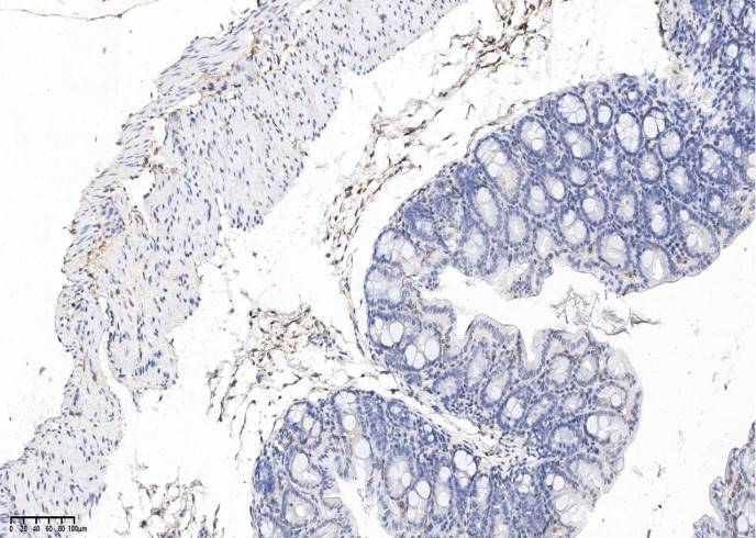 Recombinant PDGF alpha receptor/PDGFRA Monoclonal Antibody-searchlist-1