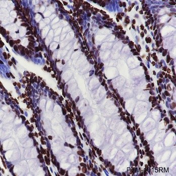 Recombinant Histone H4 (CT) Monoclonal Antibody-searchlist-3