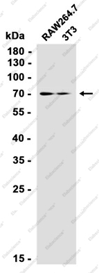 Recombinant S6K1 Monoclonal Antibody - 2