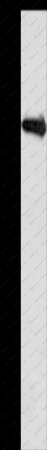 APLP1 Polyclonal Antibody - 1