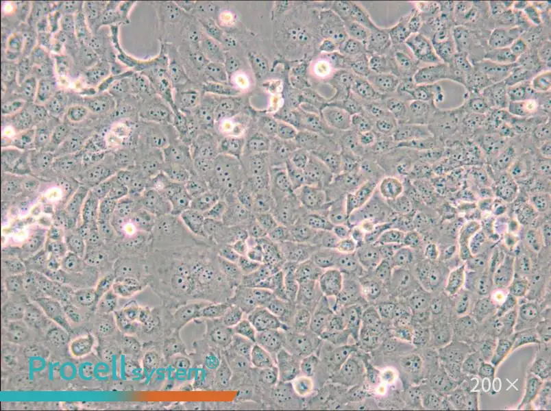B-CPAP [BC-PAP; BCPAP] Cell Complete Medium - small - 5