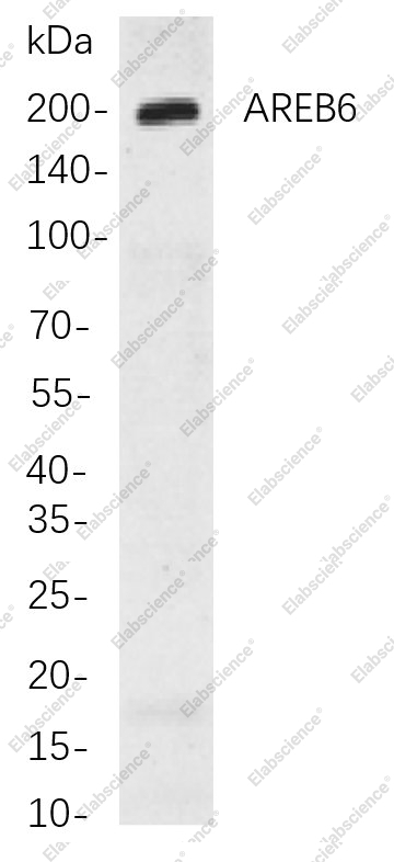 Recombinant AREB6 Monoclonal Antibody - 1
