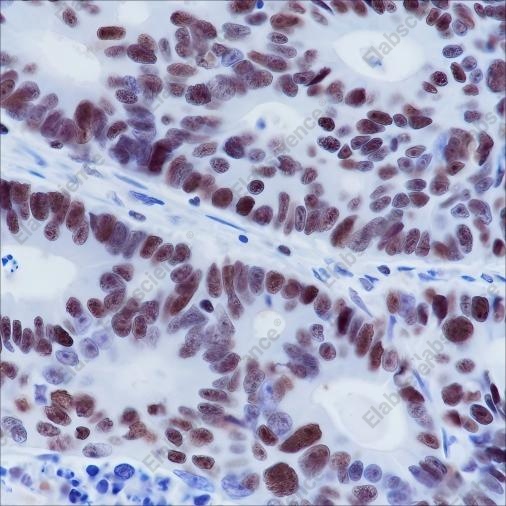 Recombinant MSH6 Monoclonal Antibody - 2