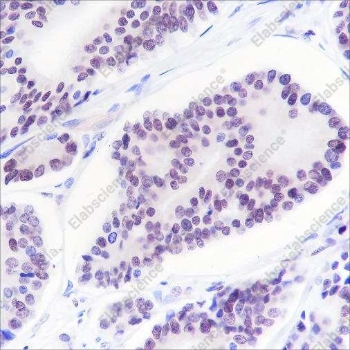 Recombinant ERG Monoclonal Antibody - 3