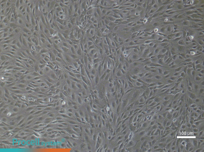 Human Pulmonary Microvascular Endothelial (Primary cell immortalization) Cell Complete MediumHuman Pulmonary Microvascular Endothelial (Primary cell immortalization) Cell Complete Medium - 3