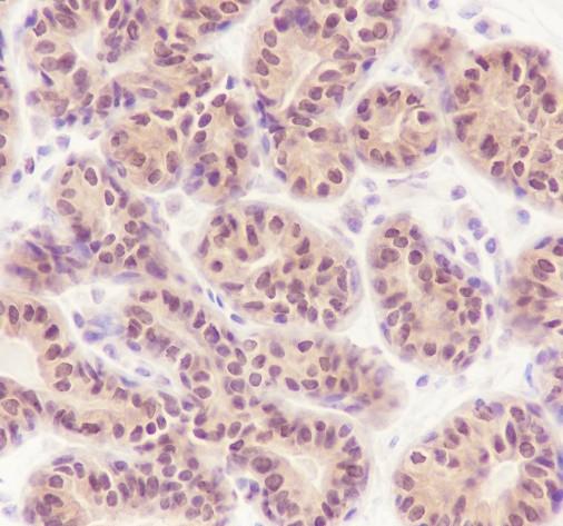 Recombinant MTAP Monoclonal Antibody - small - 3