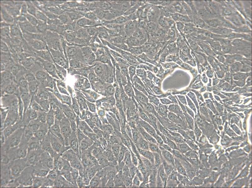 NCI-H2444 Cell Complete Medium - 5