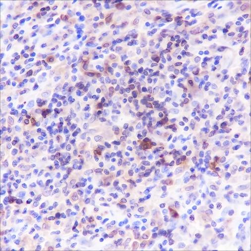 Recombinant HLA-DPA1 Monoclonal Antibody - 2