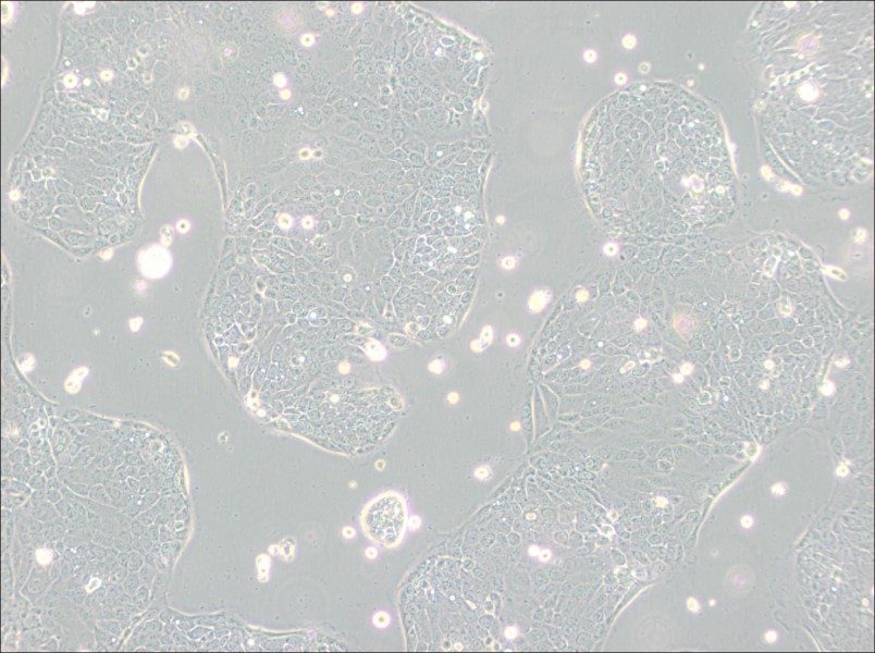 Capan-2 Cell Complete Medium - 2