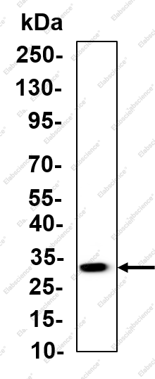Recombinant CD20 Monoclonal Antibody - 1
