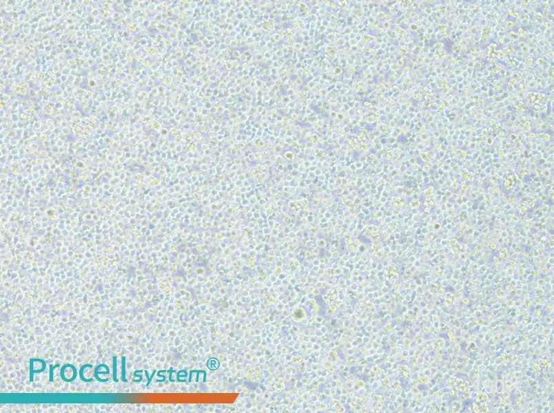 Jurkat clone A3[A3] Cell Complete Medium - 3