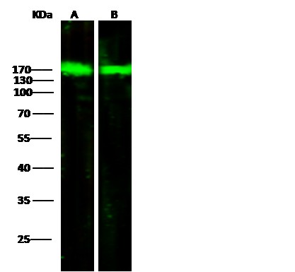 Recombinant ORP150/ORP150/HYOU1/HSP12A Monoclonal Antibody - small - 3