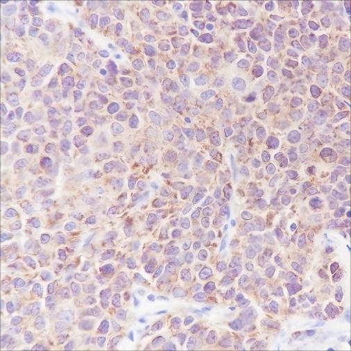 Recombinant Smac/Diablo Monoclonal Antibody - small - 2