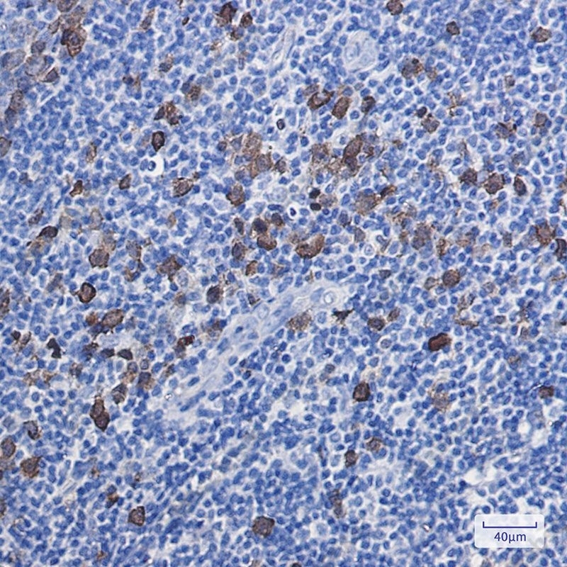 Recombinant Thymidylate Synthase Monoclonal Antibody - 3