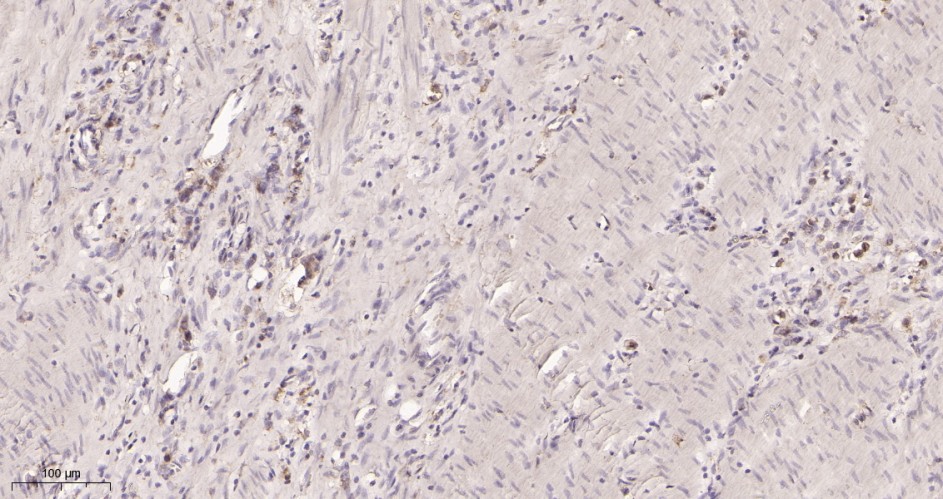 Recombinant VEGF Receptor 1 Monoclonal Antibody - small - 2