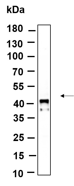Recombinant Phospho-IκB-α (Ser32) Monoclonal Antibody-searchlist-1