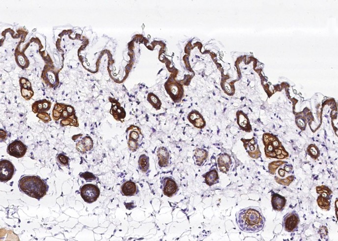 Recombinant TROP-2/TACSTD2 Monoclonal Antibody-searchlist-1