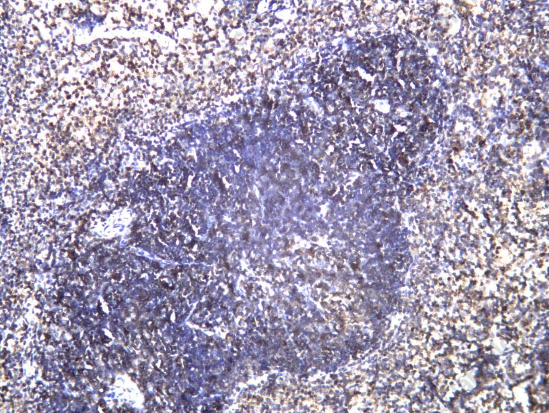 Recombinant Integrin αL Monoclonal Antibody - 1