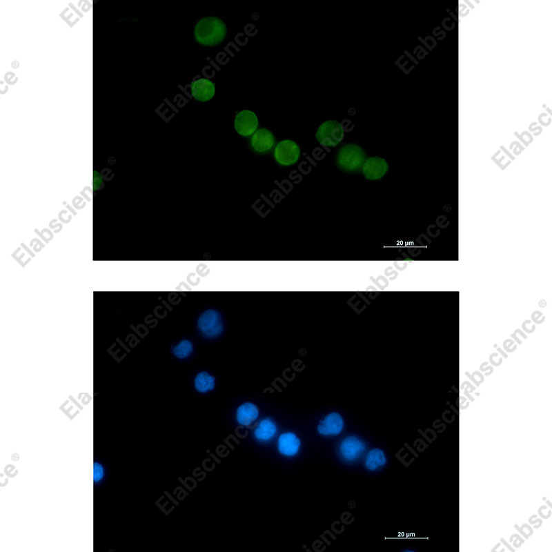 Recombinant Thymidylate Synthase Monoclonal Antibody - 2