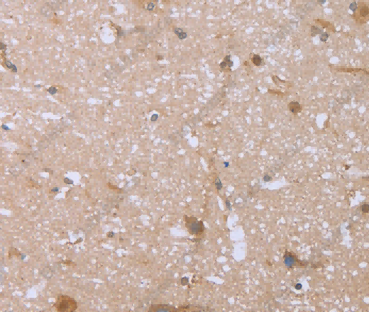 FHL2 Polyclonal Antibody - 3