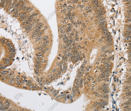 ARHGAP25 Polyclonal Antibody - 3