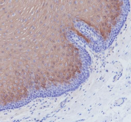 Recombinant Keratin 4 Monoclonal Antibody - 2