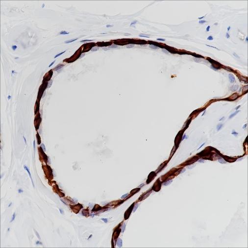 Recombinant Keratin 17 Monoclonal Antibody - 3
