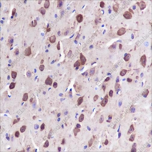 Recombinant ST13 Monoclonal Antibody - 2