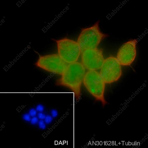 Recombinant PHF20 Monoclonal Antibody - 2