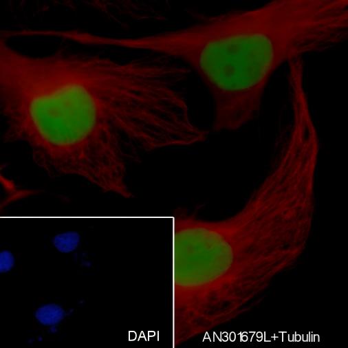 Recombinant TPX2 Monoclonal Antibody - 3