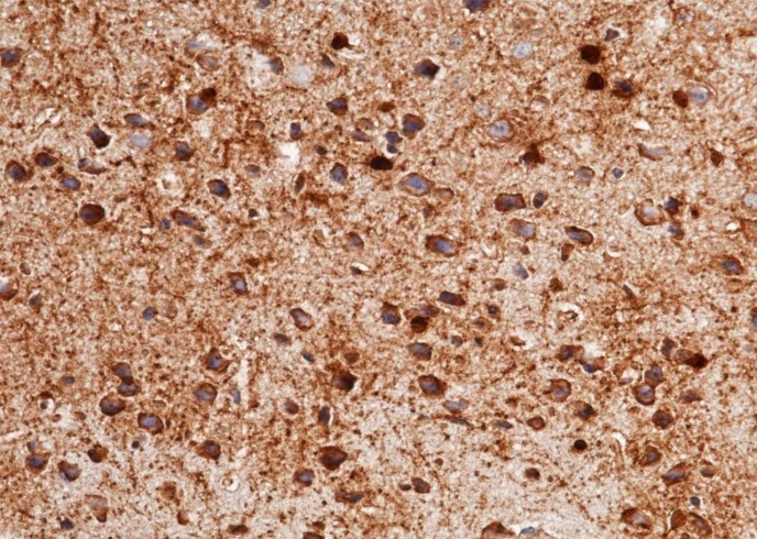 Recombinant Carbonic Anhydrase II/Car2 Monoclonal Antibody - small - 4