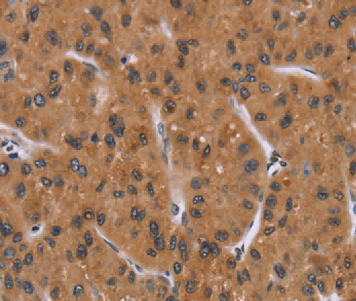 PPIB Polyclonal Antibody - 3