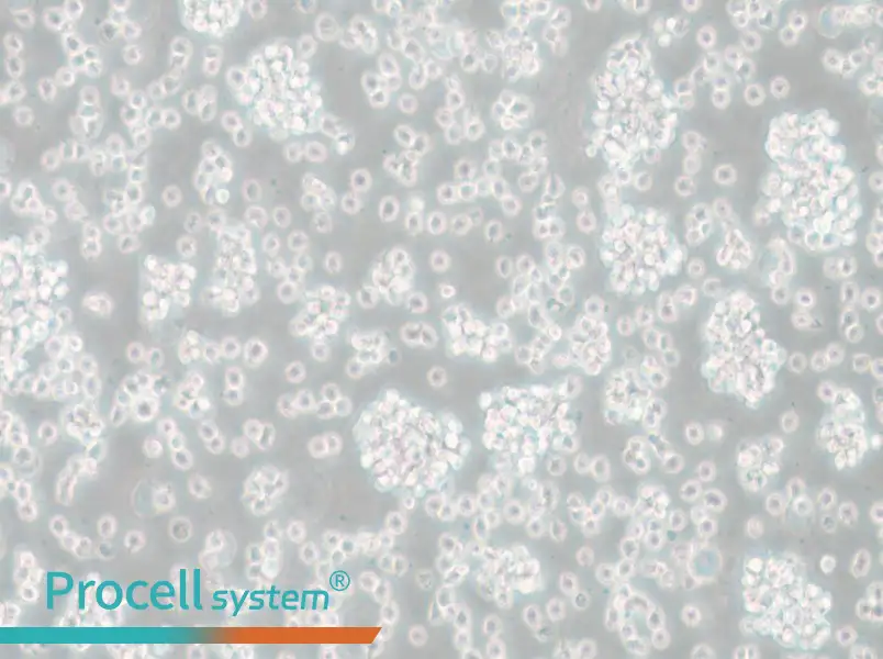 SU-DHL-6 Cell Complete Medium - 6