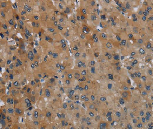FAAH Polyclonal Antibody - 2