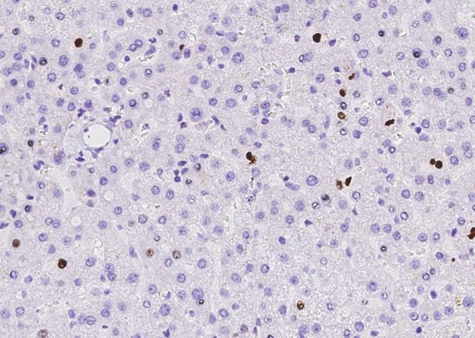 Ki67/MKI67 Monoclonal Antibody - small - 2
