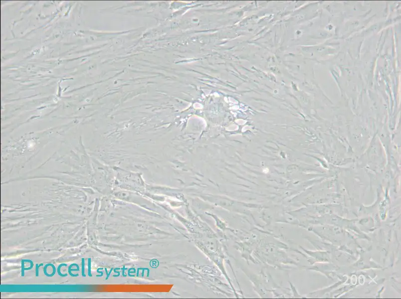 CCD-1095Sk Cell Complete Medium - 5