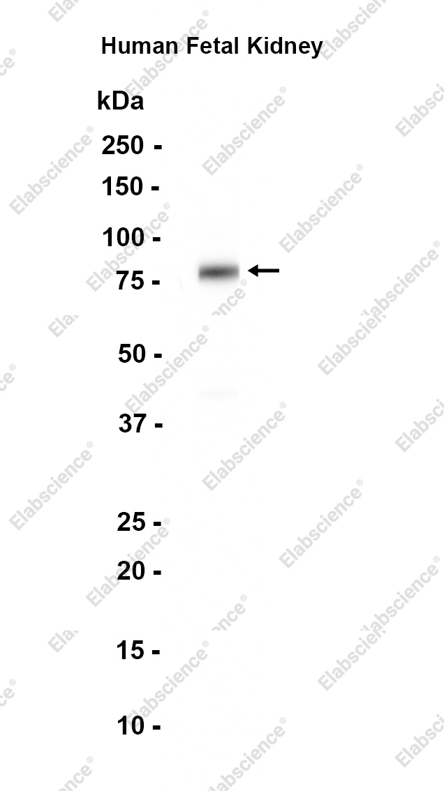 Recombinant SLC22A3 Monoclonal Antibody - 1