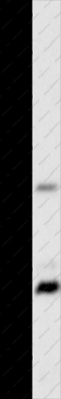MC1R Polyclonal Antibody - 1