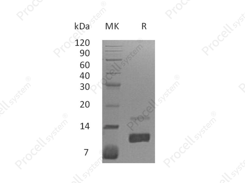 IL-8/MDNCF/NAF/CXCL8, Human, Recombinant