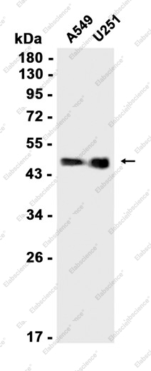 Recombinant Phospho-GATA3 (Ser308) Monoclonal Antibody - 1